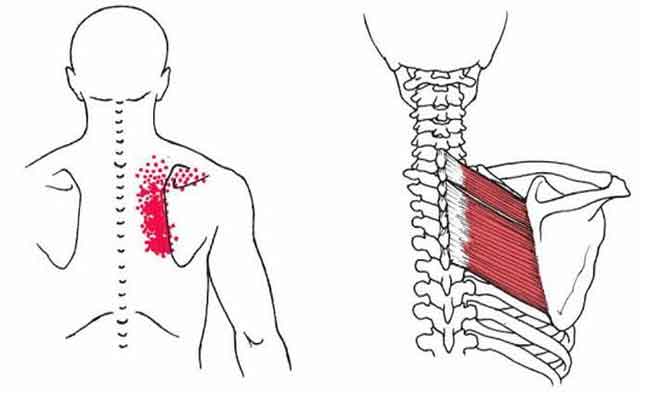 أعراض الأبهر في الكتف الأيمن…والأسباب التي قد تدعو للقلق