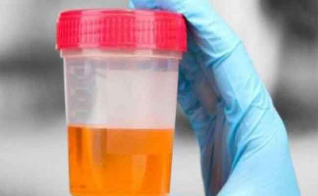 لون بول الحامل وأسباب تغيره…