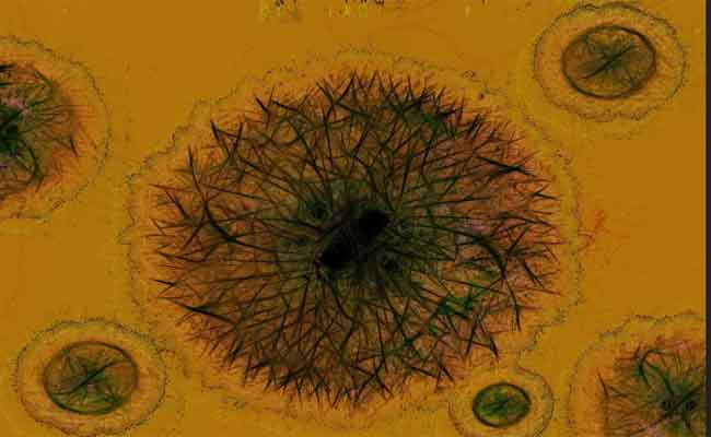 ما هو مرض X ؟ وما هي حقيقته العلمية؟…طبيب يشرح