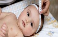 أسباب ضخامة الرأس عند الأطفال الرضع