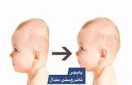 طرق حماية الطفل الرضيع من تسطح الرأس...