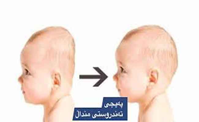 طرق حماية الطفل الرضيع من تسطح الرأس…