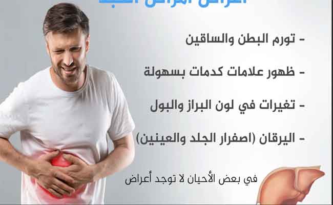 صحة الكبد: ابدئي يومك بـ3 مشروبات وفق طبيب جهاز هضمي