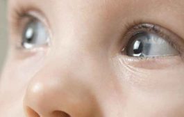 أسباب العيون الدامعة عند الأطفال وطرق علاجها...