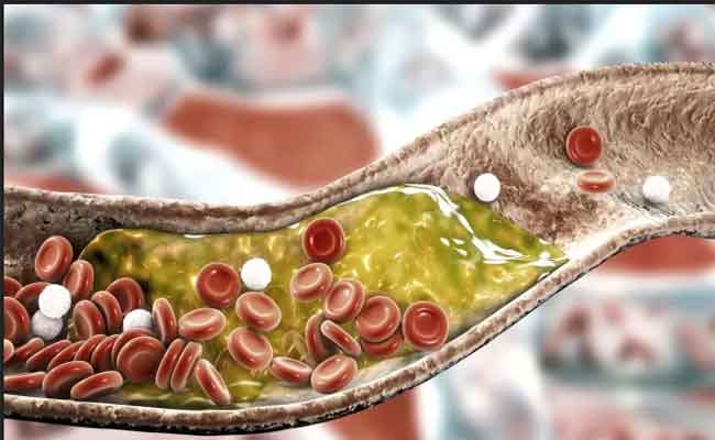 خفض الكولسترول من دون دواء…اختصاصية تتحدث