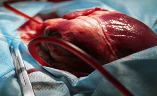 أمراض القلب…3 أنواع يكشفها لك التخطيط الحديث قبل فوات الأوان