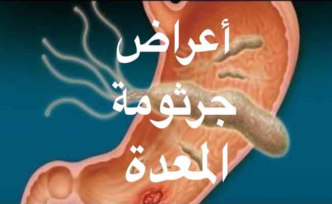 أعراض جرثومة المعدة على الرأس…قد تكون خطيرة