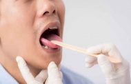 أسباب وعلاج طعم السكر في الفم...وفق طبيبة في علم التغذية