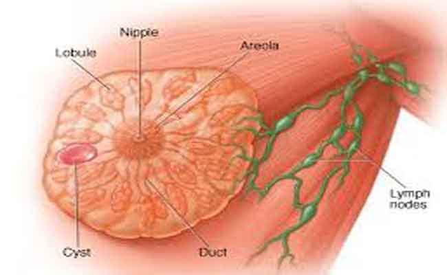 تجربتي مع ورم الثدي الحميد…لا تخلو من القلق