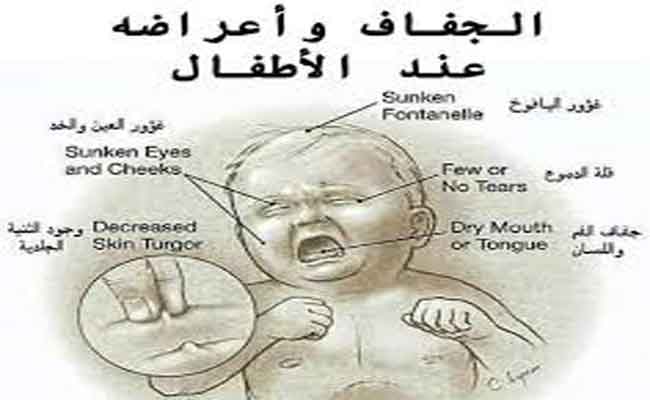 أعراض الجفاف التحذيرية عند الرضع…وكيفية التعامل معه