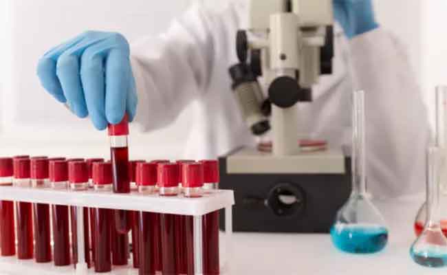 أعراض حموضة الدم تستدعي التصرف بسرعة فائقة…