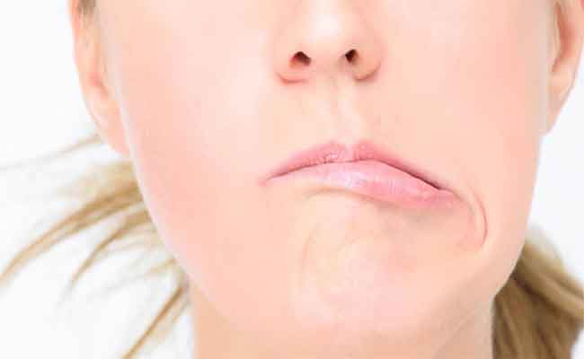 أعراض العصب السابع وضرورة التدخل السريع