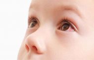 أسباب احمرار العين عند الأطفال الرضع ومتى تكون مؤشراً خطراً؟