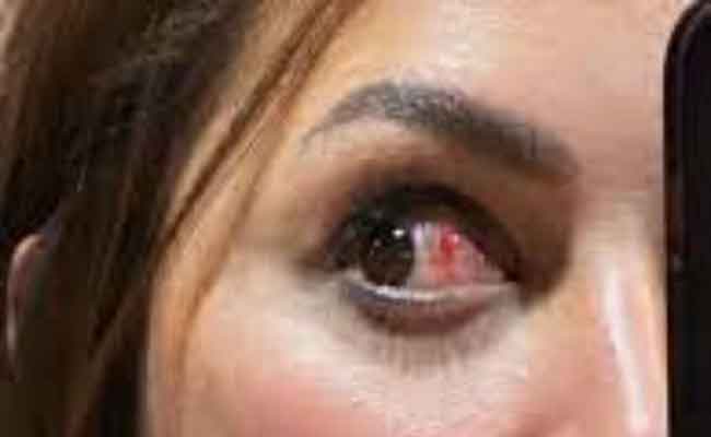 أحدثهم بسمة داوود…نجوم تعرضوا لإصابات وقت التصوير