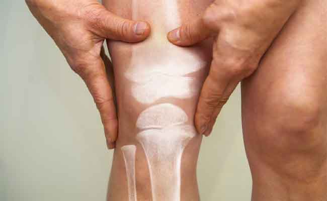 التهاب المفاصل: ابتعدي عن هذه الثمار وفق دراسة جديدة