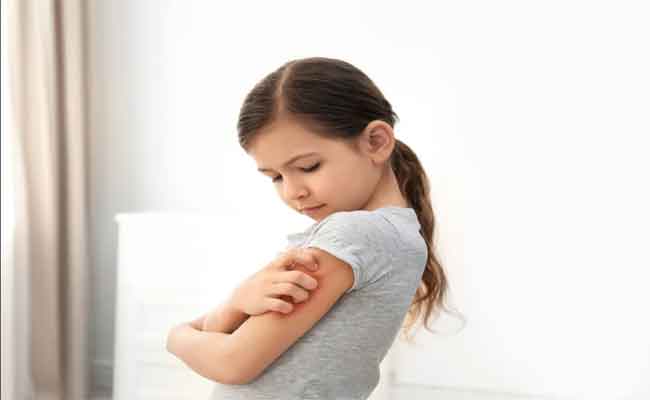 أعراض وأسباب الحساسية الغذائية عند الأطفال…وأفضل طرق التعامل معها