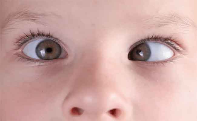 أسباب حول العين عند الأطفال والطريقة الصحيحة لعلاجه…