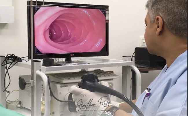 تجربتي مع منظار المعدة بالتفاصيل الدقيقة…