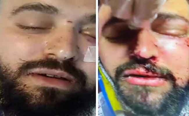 الاعتداء على مسافر جزائري على يد أحد موظفي شركة كورسيكا