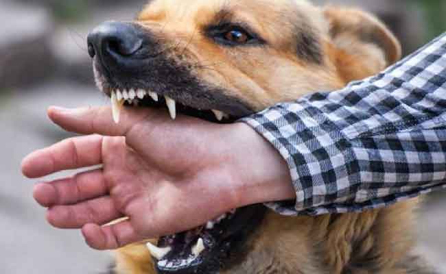 عضة كلب مسعور تنهي حياة طفل بباتنة