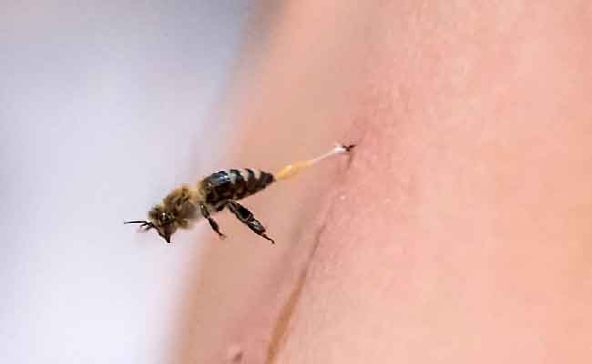 لسعات النحل تخلف مصرع شخصين وإصابة آخرين بمستغانم 