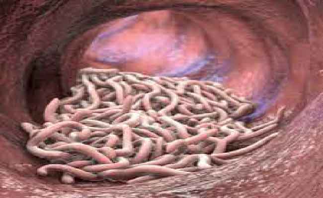 علامات إصابة طفلك بالديدان وكيفية التخلص منها نهائيًا
