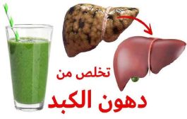 علاج دهون الكبد في المنزل ممكن بتغيير بعض العادات