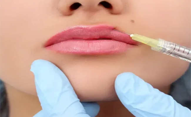 تورط طبيبة تجميل في مضاعفات حقنة فيلر استعملتها مساعدتها