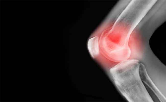 دراسة ألمانية: تقنية جديدة تخفف من آلام الركبة دون جراحة