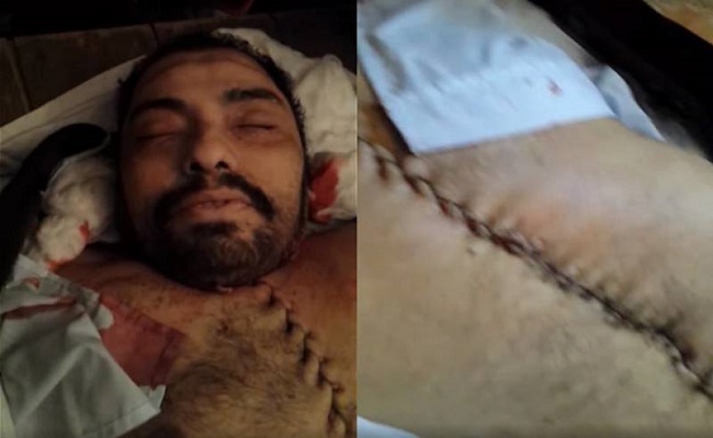 بسبب الفقر والجوع ازدهار تجارة الأعضاء بالجزائر