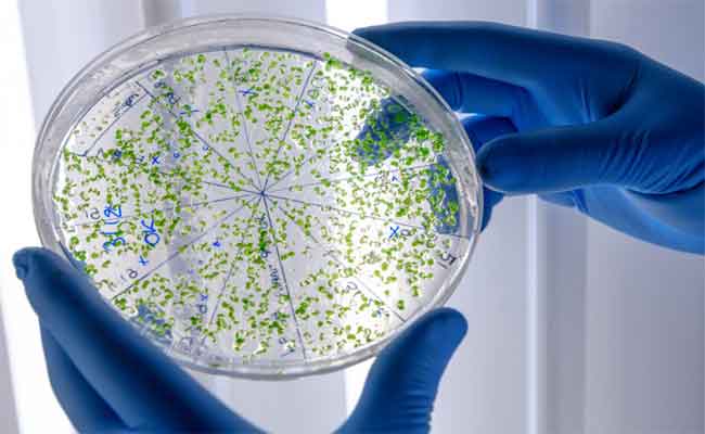 تعرفي إلى الـ E. coli البكتيريا الخطيرة التي تهدد عشاق السباحة